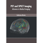 Pet and Spect Imaging: Advances in Medical Imaging - Hardcover