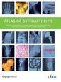 Atlas of Osteoarthritis - Paperback