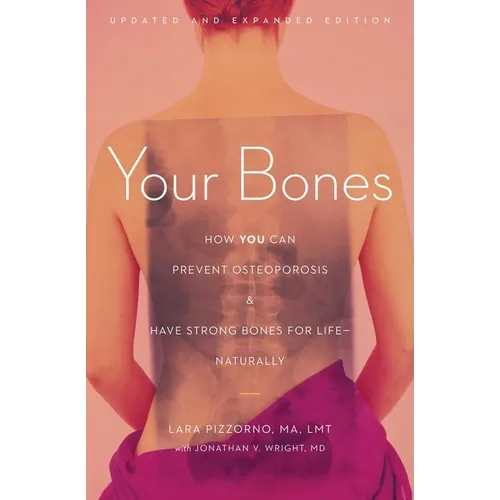 Your Bones: How You Can Prevent Osteoporosis and Have Strong Bones for Life--Naturally - Paperback