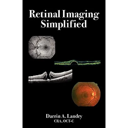 Retinal Imaging Simplified - Paperback