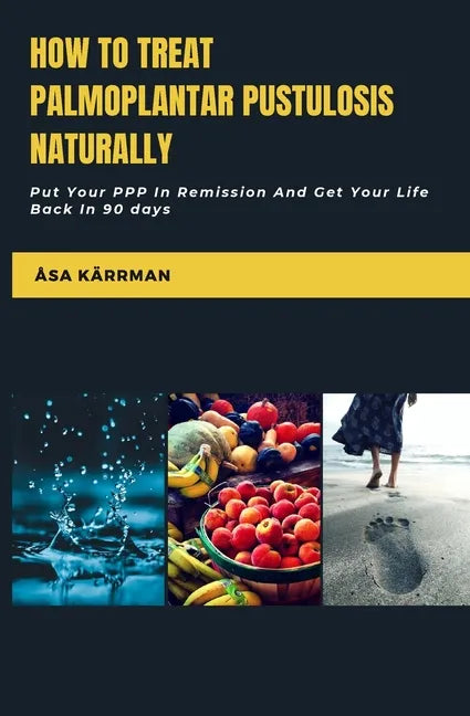 How To Treat Palmoplantar Pustulosis Naturally: Put Your PPP In Remission And Get Your Life Back In 90 Days - Paperback