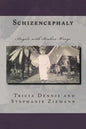 Schizencephaly - Paperback