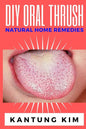 DIY Oral Thrush Natural Home Remedies: The Effective Step By Step Guide To Permanently End Oral Thrush - Paperback
