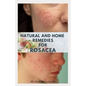 Natural and Home Remedies for Rosacea: A Self Help Guide To Completely Prevent and Treat Rosacea - Paperback