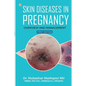 Skin Diseases in Pregnancy: Overview and Management - Paperback