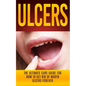 Ulcers: The Ultimate Cure Guide for How to Get Rid of Mouth Ulcers Instantly - Paperback