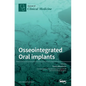 Osseointegrated Oral implants: Mechanisms of Implant Anchorage, Threats and Long-Term Survival Rates - Hardcover