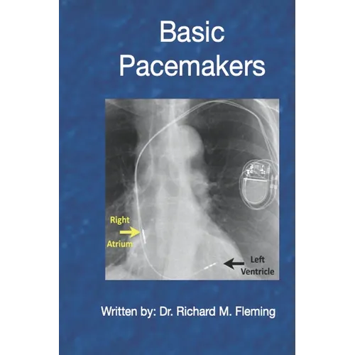 Basic Pacemakers - Paperback