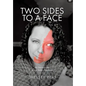 Two Sides to a Face: My Journey with Sturge Weber Syndrome - Hardcover