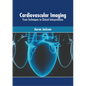 Cardiovascular Imaging: From Techniques to Clinical Interpretation - Hardcover