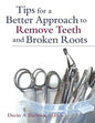 Tips for a Better Approach to Remove Teeth and Broken Roots - Paperback