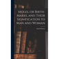 Moles, or Birth-marks, and Their Signification to Man and Woman - Hardcover