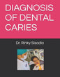 Diagnosis of Dental Caries - Paperback