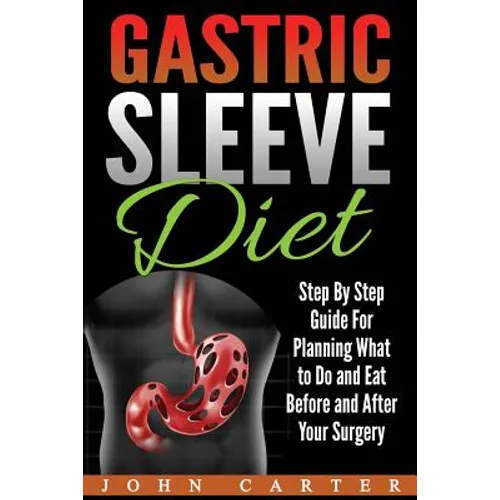 Gastric Sleeve Diet: Step By Step Guide For Planning What to Do and Eat Before and After Your Surgery - Paperback