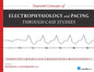 Essential Concepts of Electrophysiology and Pacing Through Case Studies - Paperback