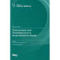 Thrombolysis and Thrombectomy in Acute Ischemic Stroke - Hardcover