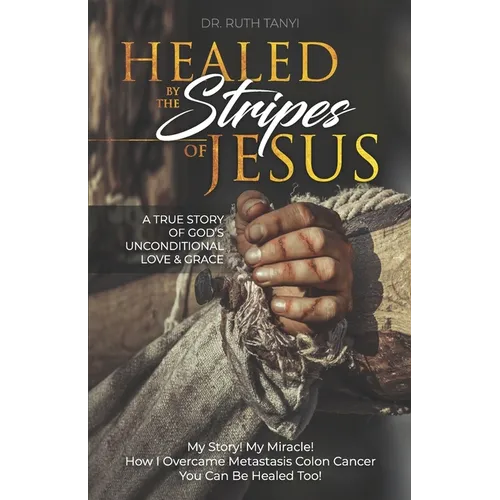 Healed by the Stripes of Jesus: A True Story of God's Unconditional Love & Grace.: My Story! My Miracle!! How I Overcame Metastasis Colon Cancer: You - Paperback