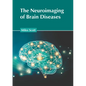 The Neuroimaging of Brain Diseases - Hardcover