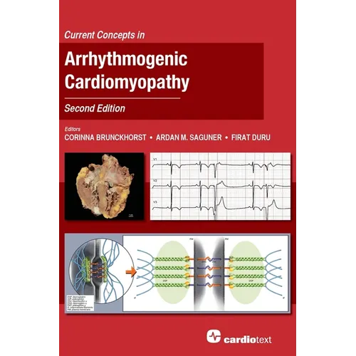 Current Concepts in Arrhythmogenic Cardiomyopathy, Second Edition - Hardcover