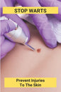 Stop Warts: Prevent Injuries To The Skin: Warts Treatment Near Me - Paperback