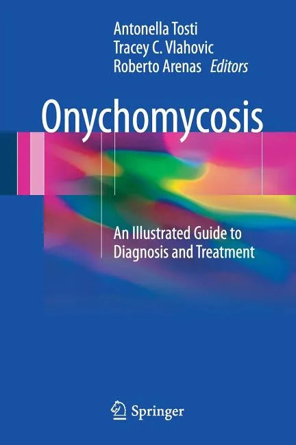 Onychomycosis: An Illustrated Guide to Diagnosis and Treatment - Paperback