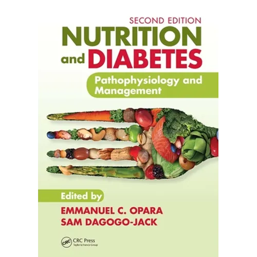 Nutrition and Diabetes: Pathophysiology and Management - Paperback
