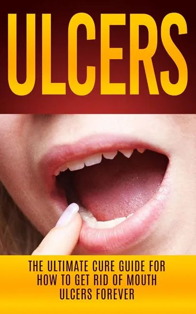 Ulcers: The Ultimate Cure Guide for How to Get Rid of Mouth Ulcers Instantly - Paperback