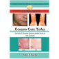 Eczema Cure Today - Get rid of Eczema forever natural ways to cure Eczema - Paperback