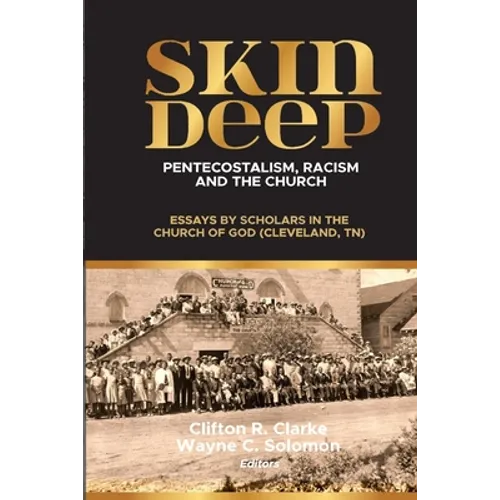 Skin Deep: Pentecostalism, Racism and the Church: - Paperback