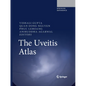 The Uveitis Atlas - Hardcover