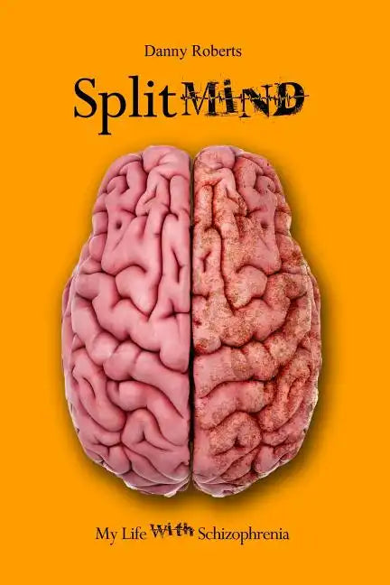 Split Mind: My Life with Schizophrenia - Paperback
