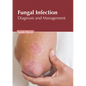 Fungal Infection: Diagnosis and Management - Hardcover