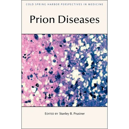 Prion Diseases - Hardcover