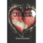 Open Wounds - Paperback