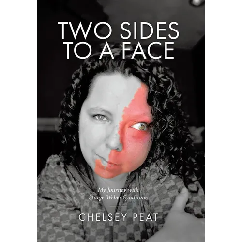 Two Sides to a Face: My Journey with Sturge Weber Syndrome - Hardcover