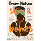 Skin & Bones - Paperback