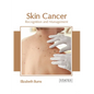 Skin Cancer: Recognition and Management - Hardcover