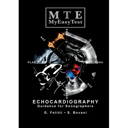 Echocardiography - MyEasyTest - Paperback