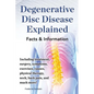 Degenerative Disc Disease Explained. Including Treatment, Surgery, Symptoms, Exercises, Causes, Physical Therapy, Neck, Back, Pain, and Much More! Fac - Paperback