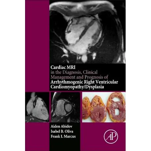 Cardiac MRI in Diagnosis, Clinical Management, and Prognosis of Arrhythmogenic Right Ventricular Cardiomyopathy/Dysplasia - Paperback