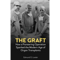 The Graft: How a Pioneering Operation Sparked the Modern Age of Organ Transplants - Hardcover