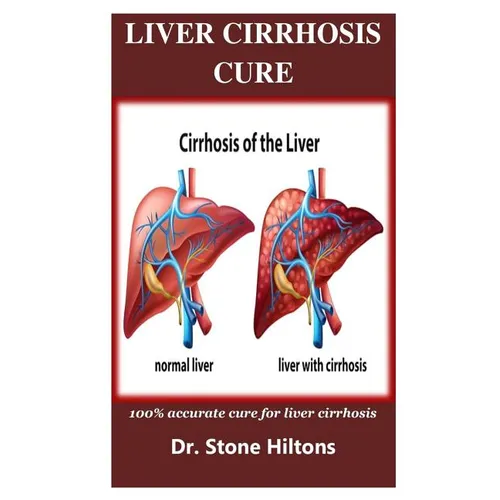 Liver Cirrhosis Cure: 100% accurate cure for liver cirrhosis - Paperback