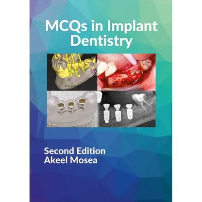 MCQs in Implant Dentistry - Paperback