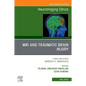 MRI and Traumatic Brain Injury, an Issue of Neuroimaging Clinics of North America: Volume 33-2 - Hardcover
