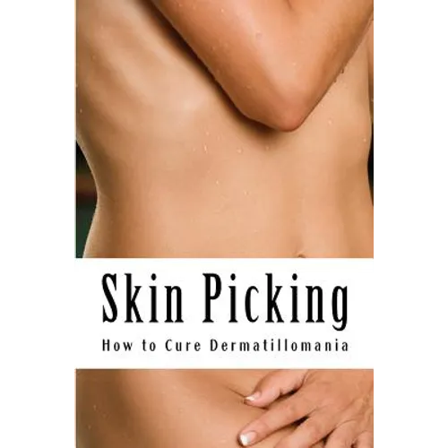 Skin Picking: How to Cure Dermatillomania - Paperback