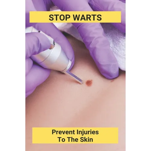 Stop Warts: Prevent Injuries To The Skin: Warts Treatment Near Me - Paperback
