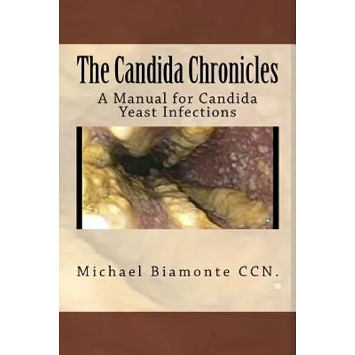 The Candida Chronicles: A Mannual for Candida/Yeast Infections - Paperback