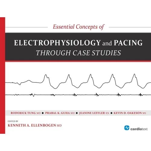 Essential Concepts of Electrophysiology and Pacing Through Case Studies - Paperback