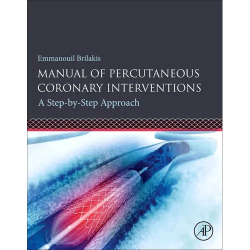 Manual of Percutaneous Coronary Interventions: A Step-By-Step Approach - Paperback