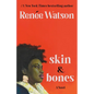 Skin & Bones - Hardcover